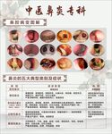 中医鼻炎专科宣传页展示