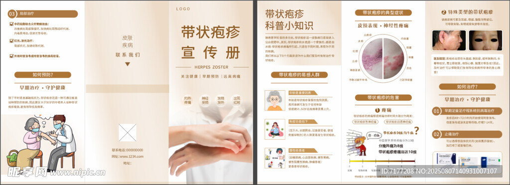 医院三折页带状疱疹