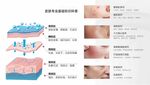 皮肤结构与问题图示展版