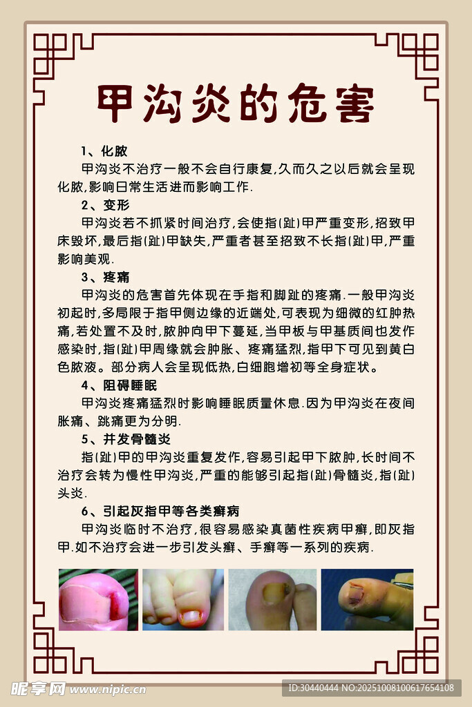 甲沟炎危害科普介绍