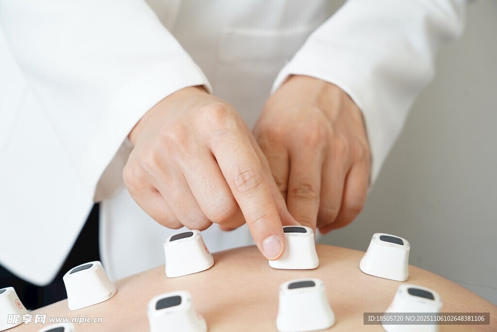 中医理疗之穴位电极片治疗