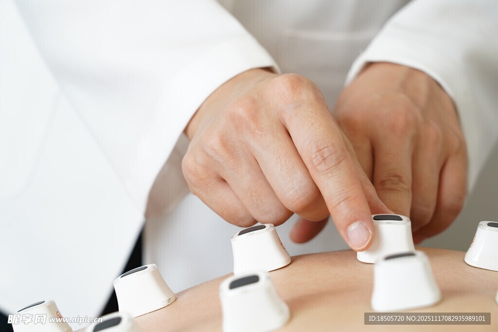 中医拔罐疗法现场操作