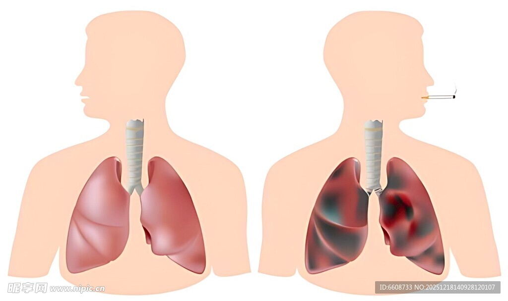 肺部健康对比图