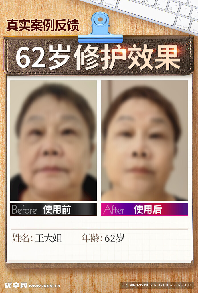 皮肤修护前后对比