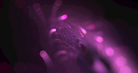 紫色光影斑点晚会粒子舞台背景