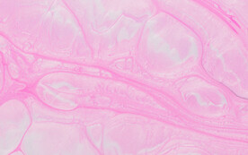 粉色纹抽象纹理背景