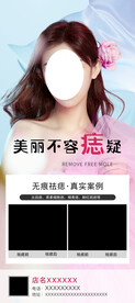 祛痣海报