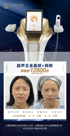 医美整形 超声王 设备海报 产