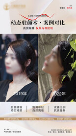 医美整形 幼态脸案例 对比 