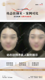 医美整形 幼态脸案例 对比 