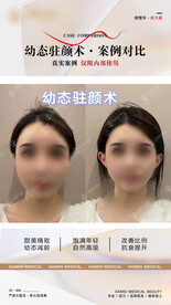 医美整形 幼态脸案例 对比 