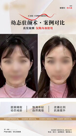医美整形 幼态脸案例 对比 