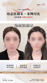 医美整形 幼态脸案例 对比 