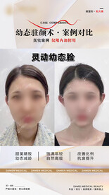 医美整形 幼态脸案例 对比 