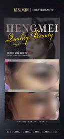 医美案例对比