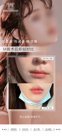 M唇部案例对比