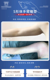 手臂精雕对比图