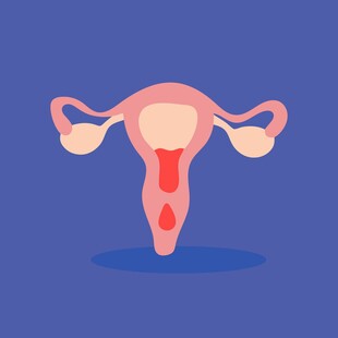 女性子宫经期出血示意图