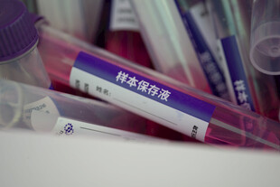 血液检测样本试管特写