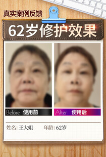 皮肤修护前后对比