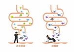 肠漏症示意图矢量