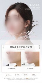 玻尿酸丰下巴案例