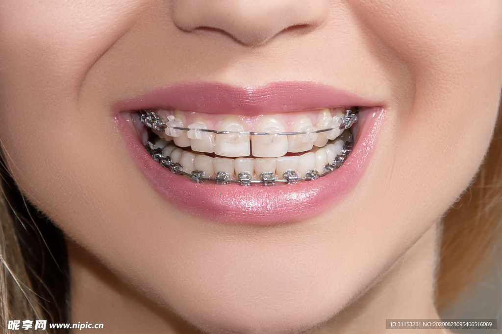 牙齿矫正