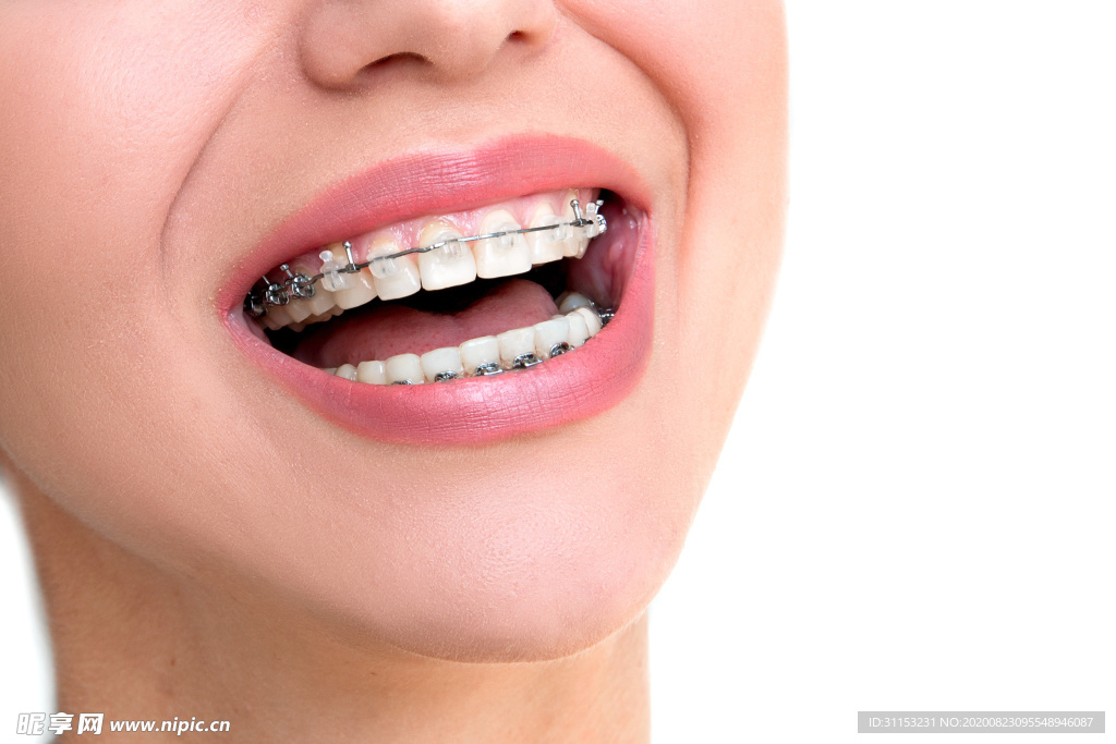 牙齿矫正
