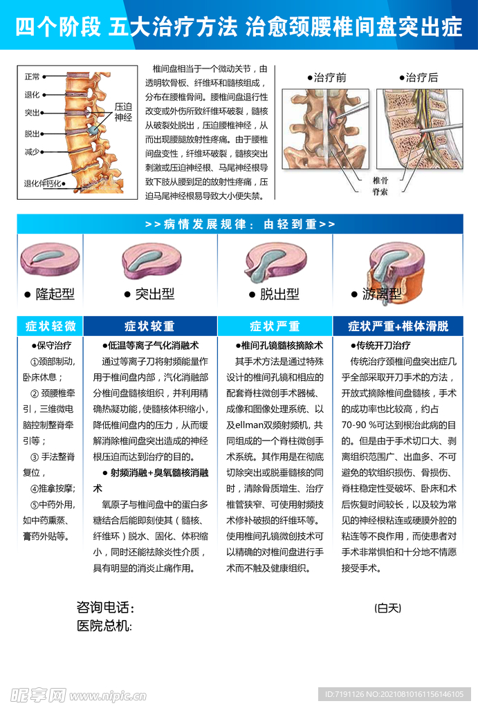 5大治疗方法治愈颈腰椎间盘突出