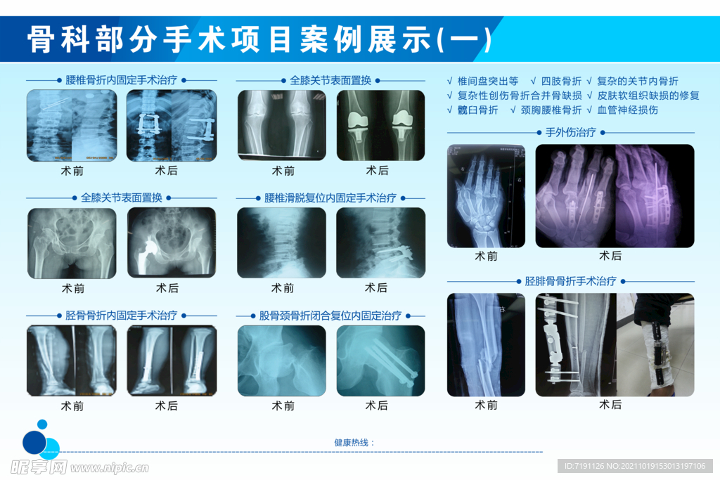 骨科部分手术项目案例展示