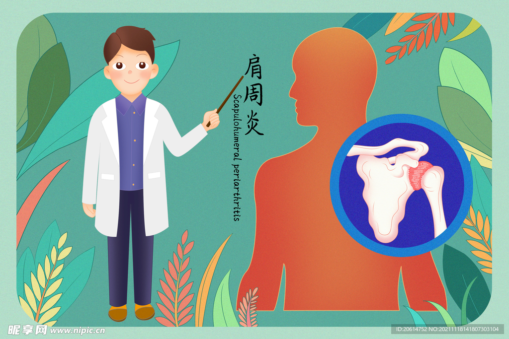 预防肩周炎讲座