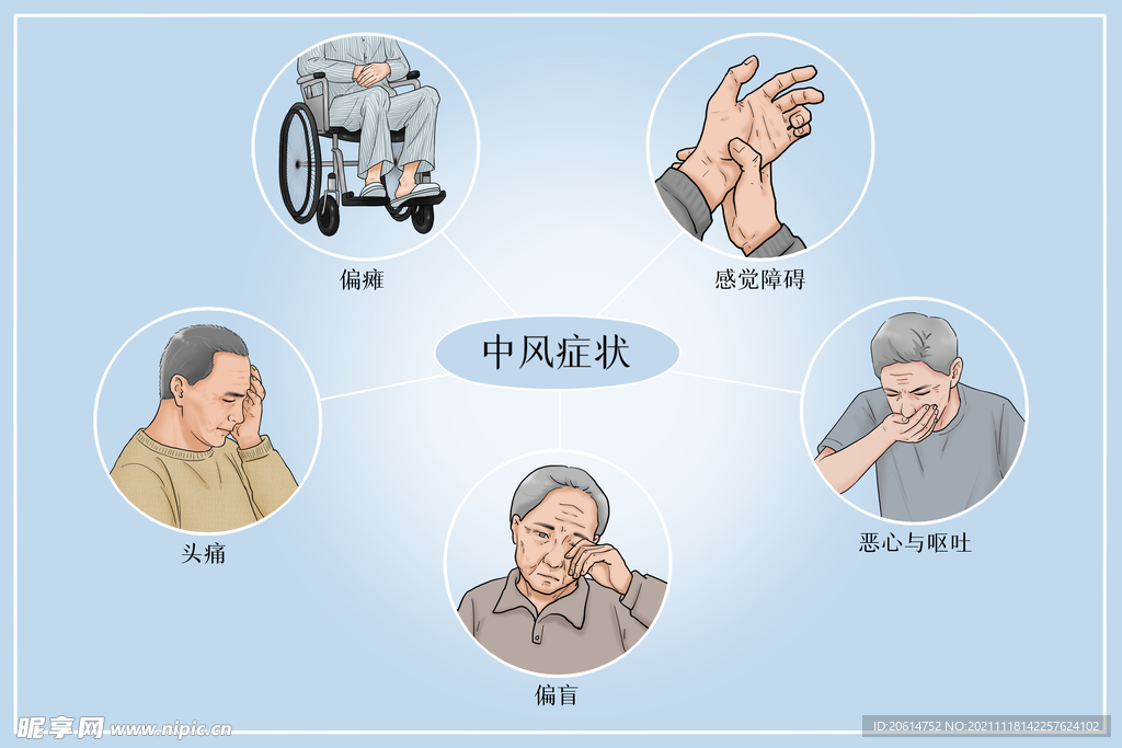 中风