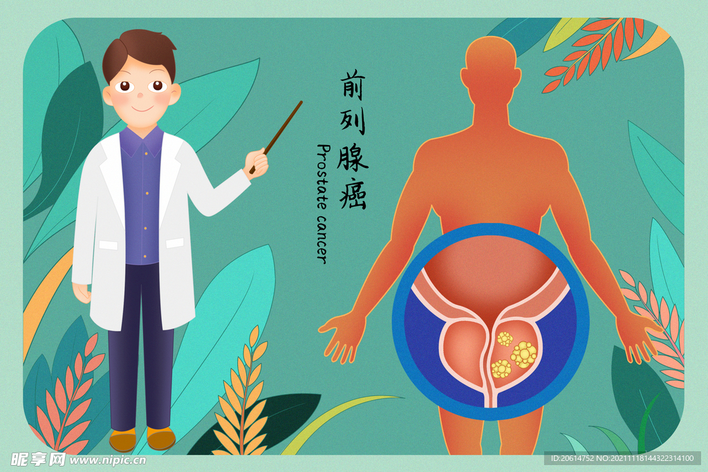 前列腺癌