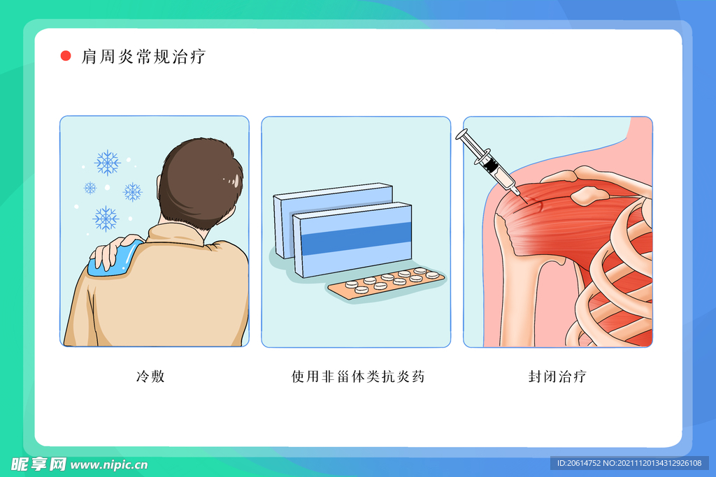 肩周炎治疗