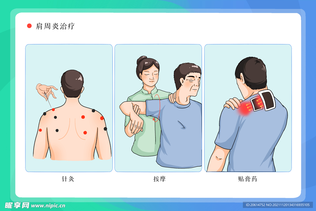 肩周炎治疗