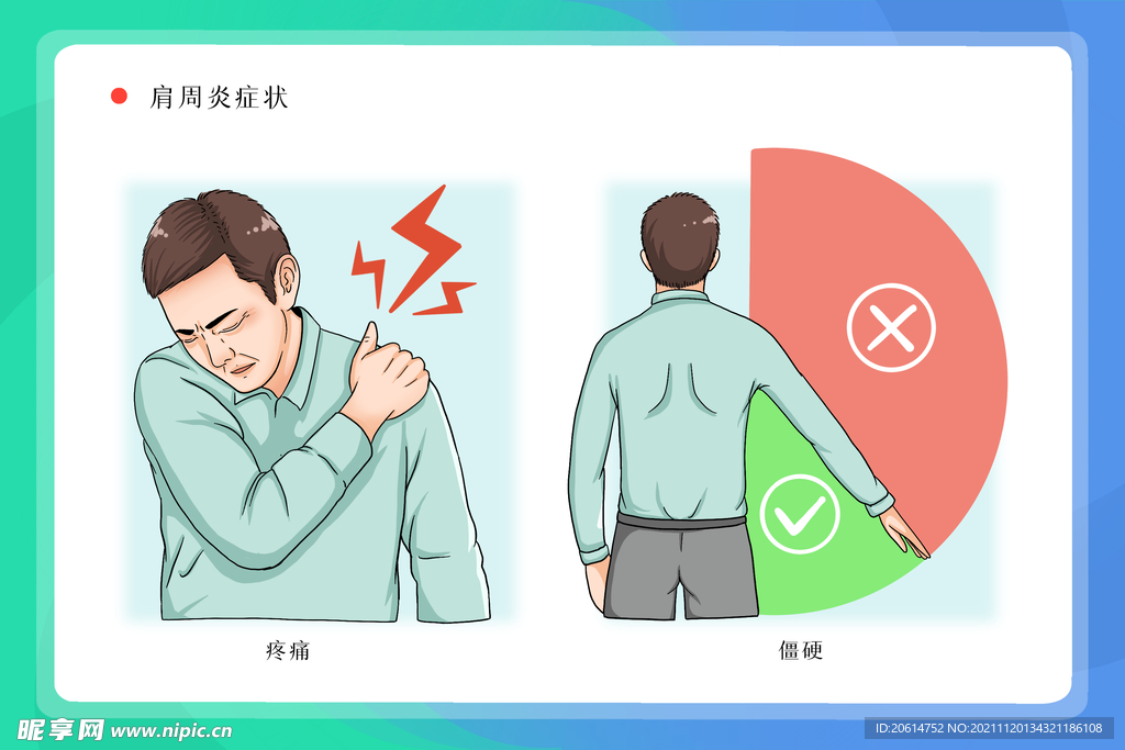 肩周炎