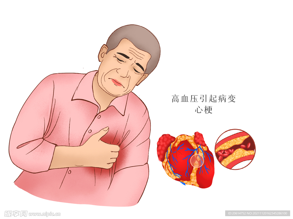 疾病漫画展示预防