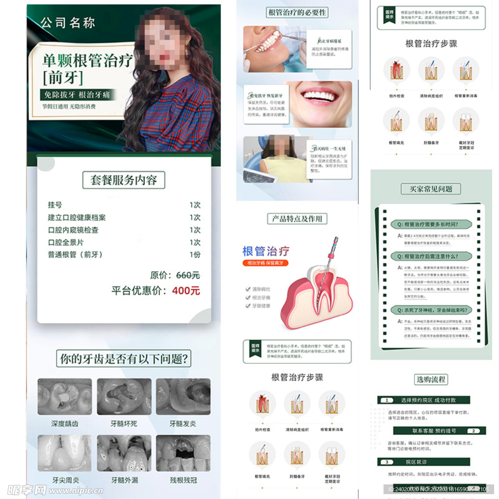 口腔根管治疗详情页