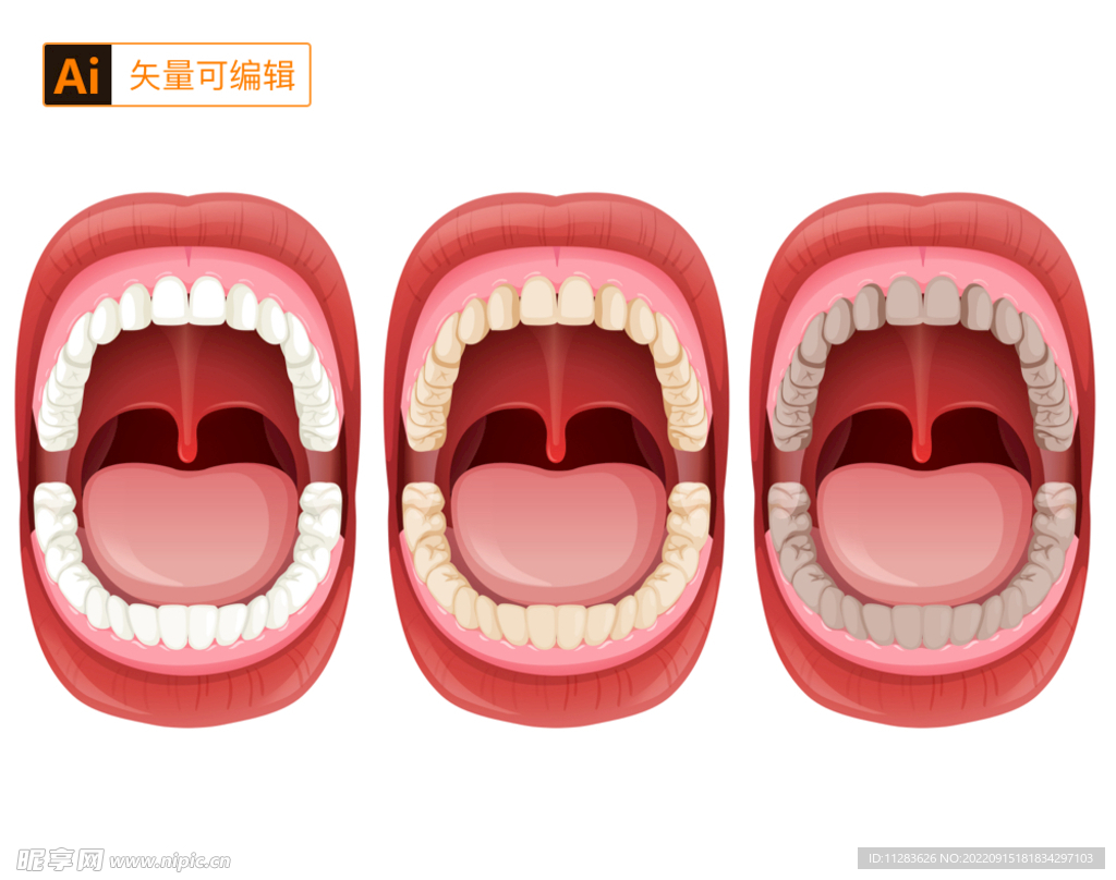 口腔插画