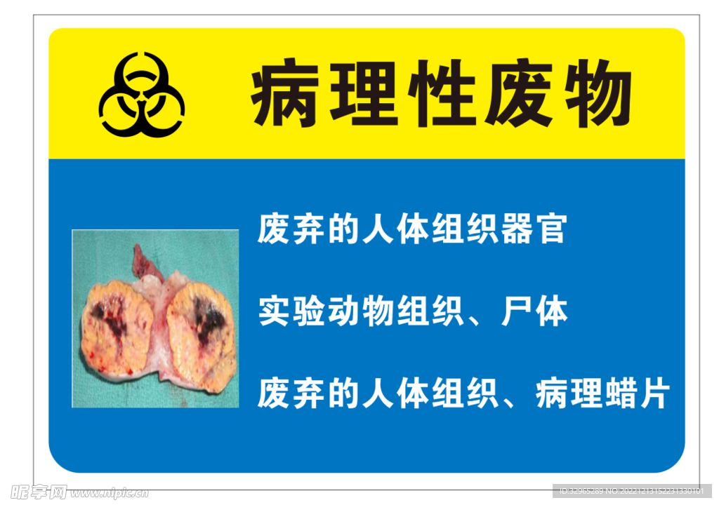 医院手术室病理性废物警示牌