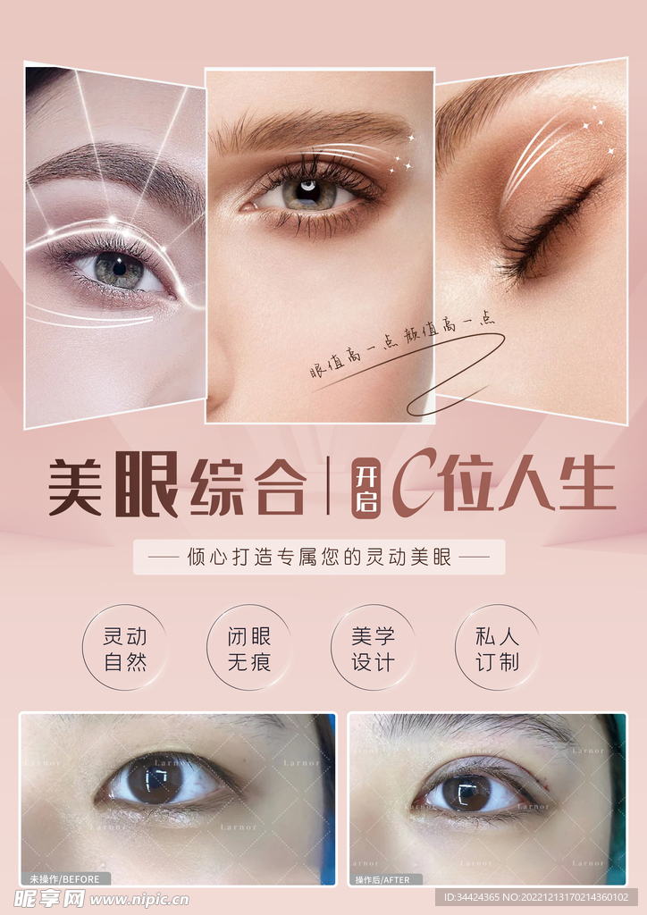 眼综合