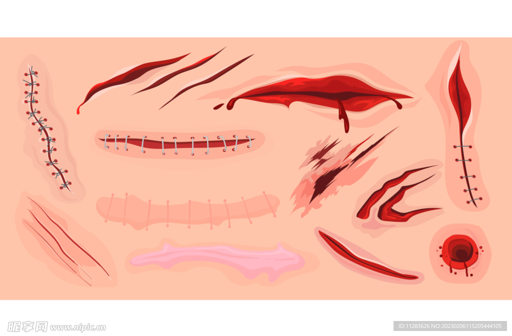 伤口插画