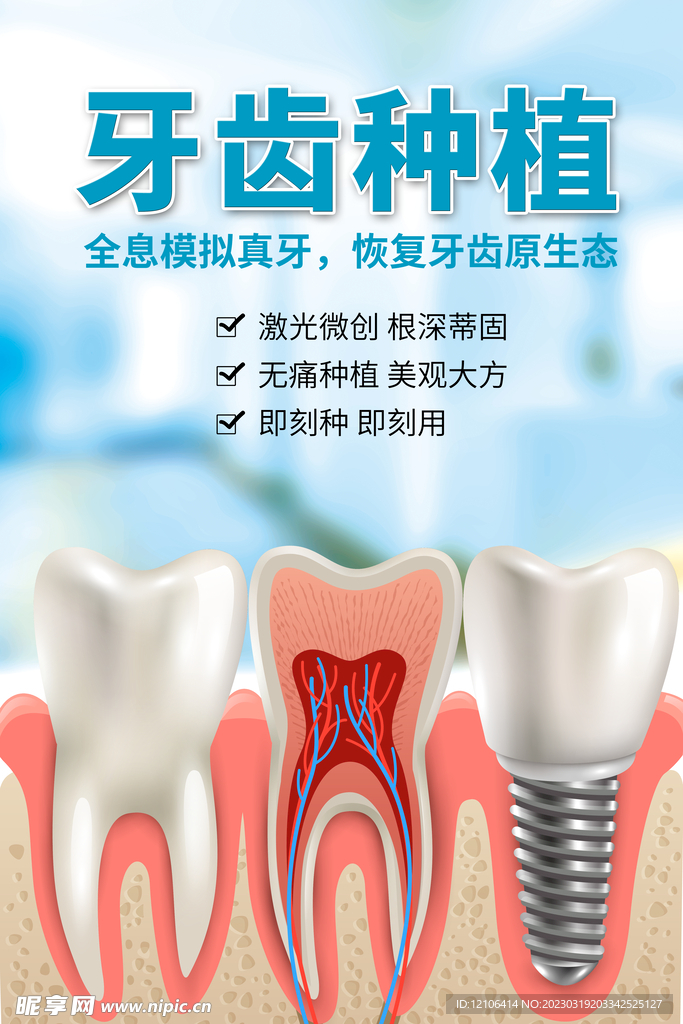 牙齿种植海报