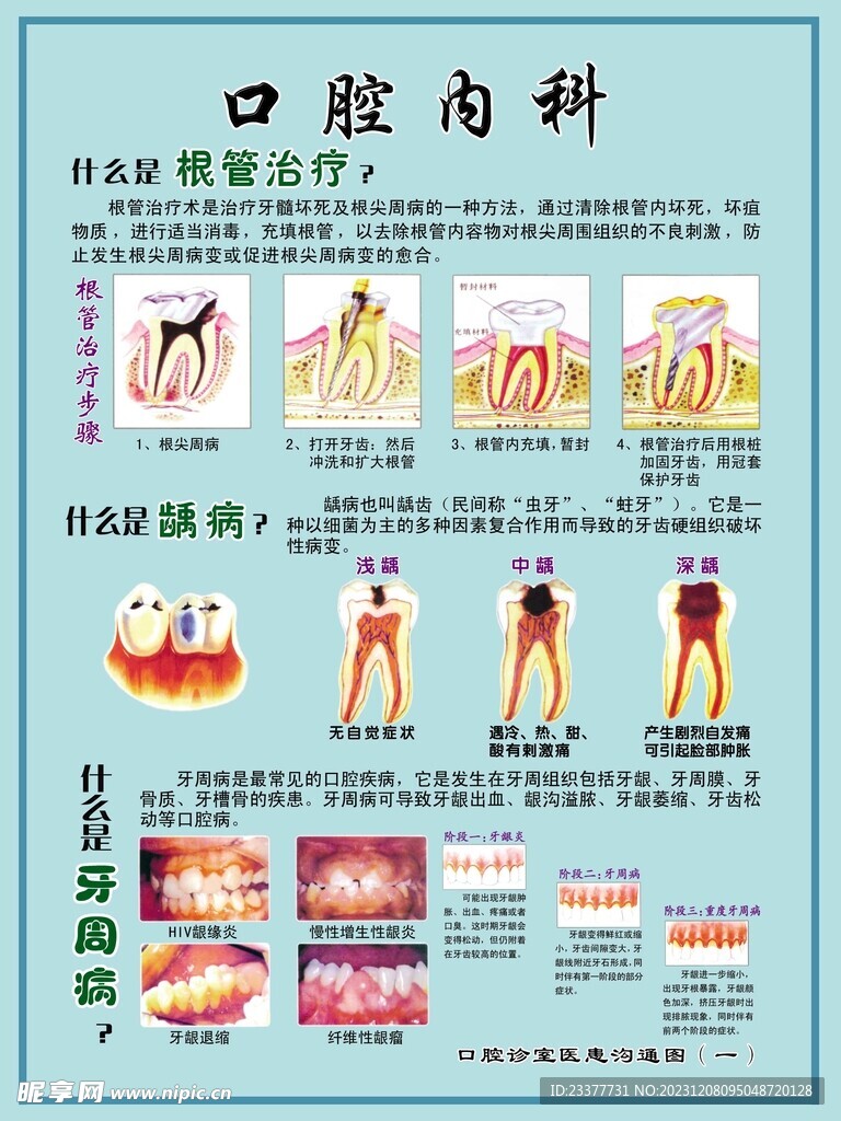 根管治疗口腔内科展板