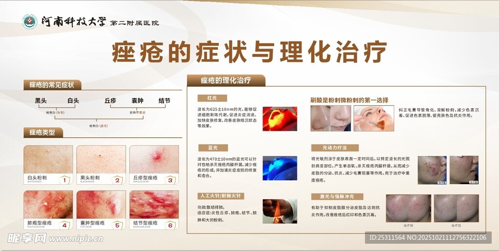 痤疮的症状与物理治疗