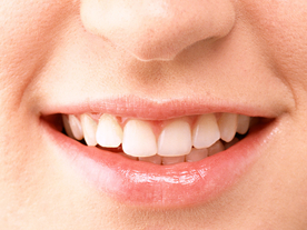 嘴唇接吻唇角口红图片