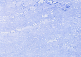 石材纹理材质贴图图片