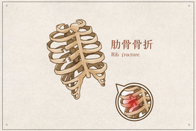 肋骨骨折骨科宣传展板素材