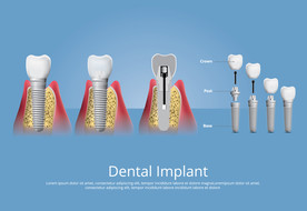 牙齿 口腔 医科