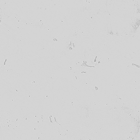 金属垃圾绘01咬合